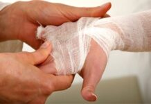 Skaudžios gaisrų pasekmės – nudegimai