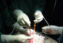 Dažnai transplantacijos laukimo laikas jau trumpesnis nei privaloma tarnyba Lietuvos kariuomenėje
