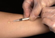 Tuberkulioze gali užsikrėsti visi, kas kvėpuoja
