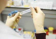 Testavimas dėl COVID-19 nuo gruodžio 1 d. taps mokamas: kaip reikės testuotis darbuotojams?