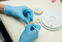 Dantų implantų kaina: kiek racionalu mokėti?