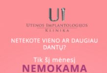 Šiuolaikinė implantacija – visi dantys ir geresnė sveikata
